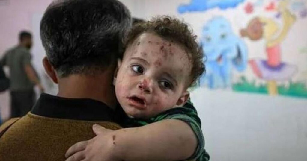 5000 إصابة أسبوعيًا: تحذيرات من اتساع رقعة “جدري الماء” في قطاع غزة